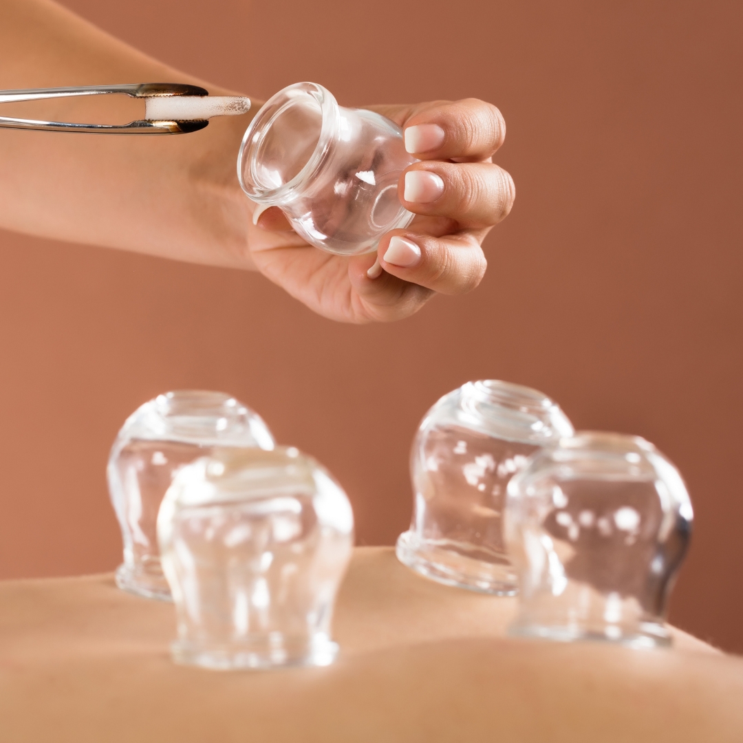 The Science Behind Cupping